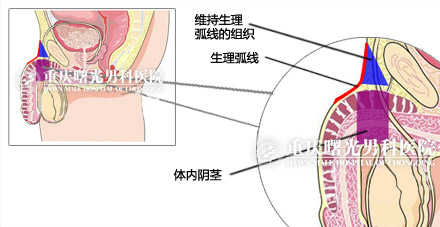 为非勃起状态下的阴茎矢状面解剖图