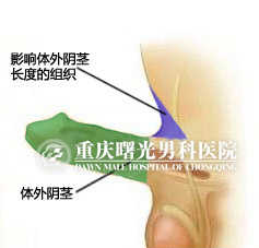 为勃起状态下的阴茎矢状面解
