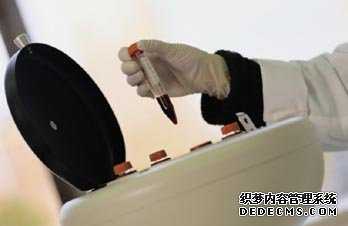 查前列腺炎 要做哪些检查?