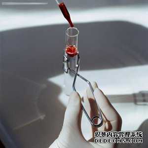 阳痿需要做哪些检查?